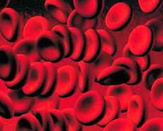 Collection of ketone bodies in the blood of diabetes